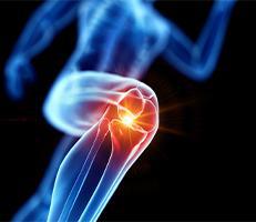 aoi-knee-arthritis