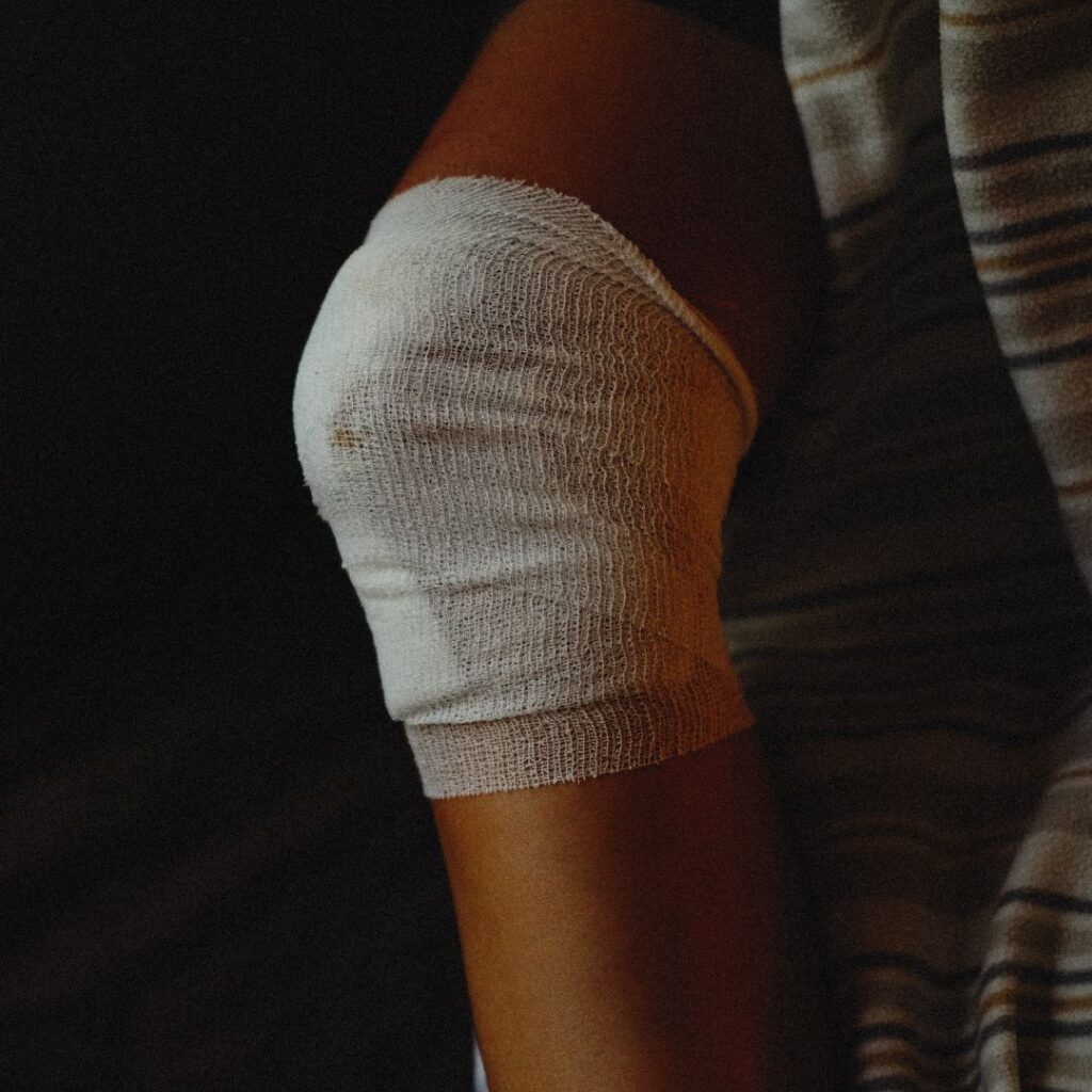 AOI-Signs You Need to See a Knee Replacement Specialist 6 A knee wrapped in gauze