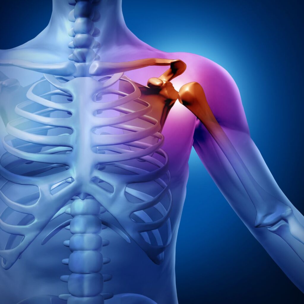 AOI-The Importance of Early Diagnosis in Shoulder Care 1 An injured shoulder