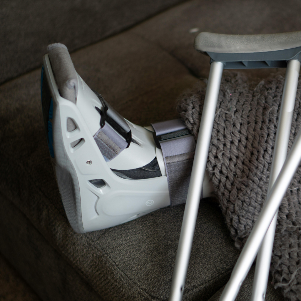 AOI-When to Consult an Orthopedic Trauma Surgeon 1 broken leg