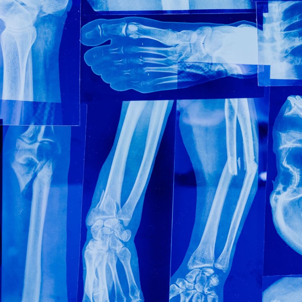 AOI-The Importance of Timely Orthopedic Trauma Care 1 AOI-Trauma